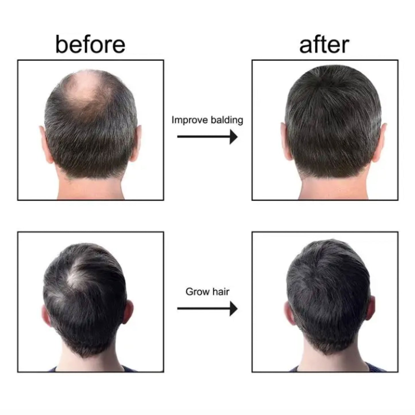 Huile Essentielle Capillaire – Nourrit et Protège Vos Cheveux